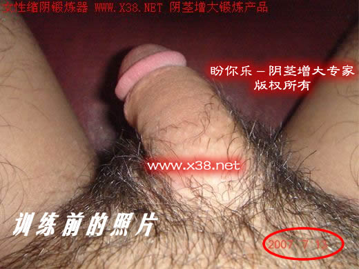 阴茎