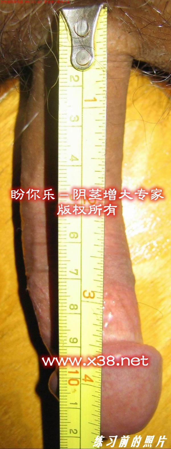 阴茎